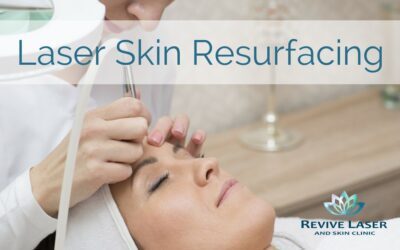 Laser Skin Resurfacing