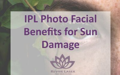 IPL Photo Facial Benefits for Sun Damage